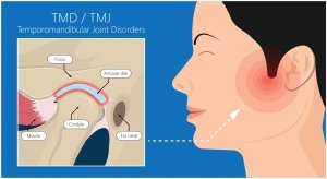 tmj dentist billerica