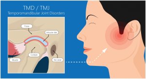 tmj dentist billerica